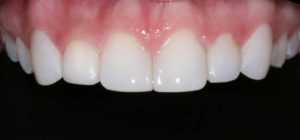dBioclear comprehensive case 3 after-b